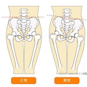 生理痛　その2